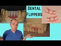 What is a dental flipper?