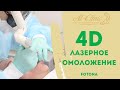 😯 УВЕЛИЧЕНИЕ ГУБ ЛАЗЕРОМ?! | 4D ОМОЛОЖЕНИЕ ЛИЦА на лазере Fotona | На 10 лет моложе за 30 минут