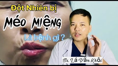 Bị méo miệng là bệnh gì năm 2024