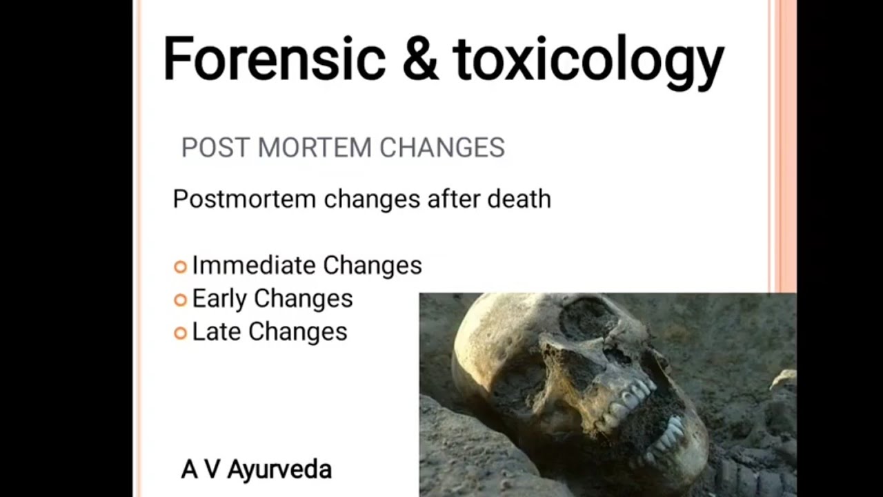 Early change after death part-2/postmortem changes/ Algor mortis ...