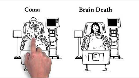 How is Brain Death Different than Coma? - DayDayNews