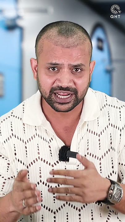 Youtuber Topa Bhai ( Nadeem Bunny ) One Month Hair Transplant Progress #shorts#hairtransplant