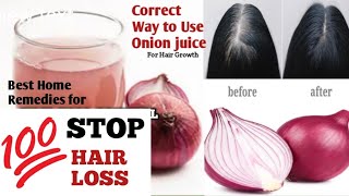 7 days only-  Hair Fall Solution ,Hair Fall Solution at Home,  100%Effective,