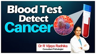 Blood Test Detect Cancer Dr R Vijaya Radhika Consultant Pathologist