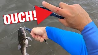 Stung By A Hardhead Catfish Painful