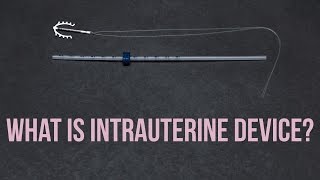 What You Need To Know About  Intrauterine Device (IUD) | Birth Control 101