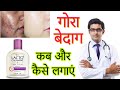 Lacto Calamine face lotion HONEST Review 2023 in hindi | Results, Benefits, Uses, Price Info