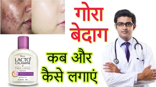 Lacto Calamine face lotion HONEST Review 2023 in hindi | Results, Benefits, Uses, Price Info