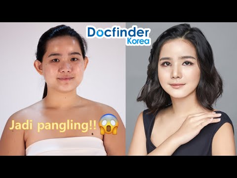 Kisah vlogger Filipina yang OPLAS di Korea 1 / 2