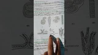 Kingdom - monera || cyanobacteria( सायनोबैक्टीरिया- नील- हरित शैवाल) example #monera #biology #neet