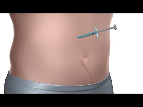 Vastus Lateralis Intramuscular Injection - Everything You Need To Know - Dr. Nabil Ebraheim