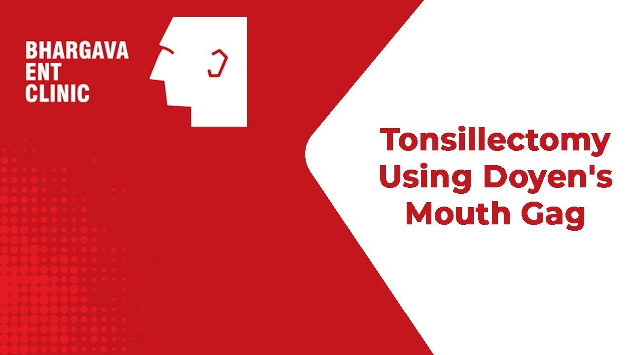 Tonsillectomy Using Doyen's Mouth Gag YouTube