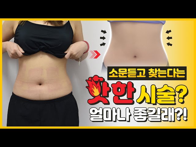 지방흡입보다 소문듣고 찾는 지방분해주사 뽑기주사 뱃살 다이어트 되고 있는거지? [플라덴TV]