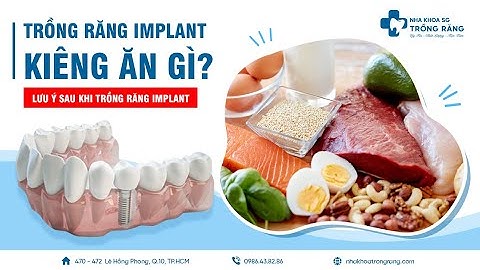 Trồng răng implant kiêng ăn gì? | Lưu ý sau khi cấy ghép implant