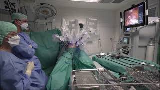 Adipositaschirurgie: Der Magenbypass mit dem Da Vinci-Roboter