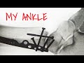How i broke my ankle kiteboarding  vlog 50