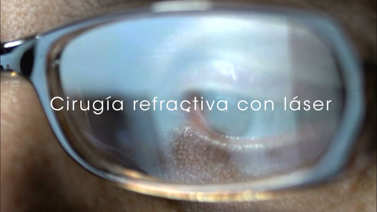 Cirugía refractiva con láser - Lasik - YouTube