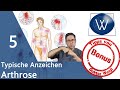 Arthrose-Lüge: 5 Anzeichen für Arthrose im Gelenk - diese Symptome & Tipps sollten Sie kennen ⚠️