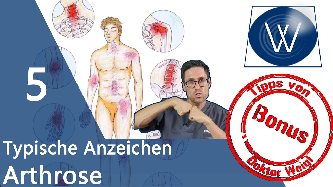 Update Arthrose-Lüge: 5 Anzeichen für Arthrose im Gelenk - diese Symptome \u0026 Tipps sollten Sie kennen ⚠️