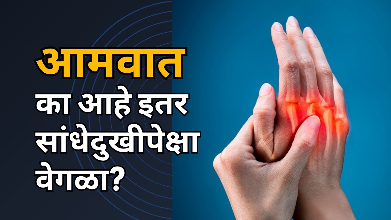आमवात का होतो? त्याची लक्षणे व उपचार -संपूर्ण माहिती।Rheumatoid arthritis।