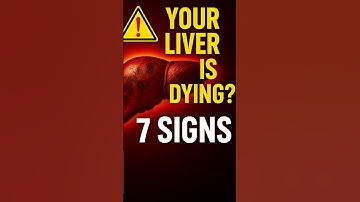 Are These 7 Liver Failure Signs Hiding in Plain Sight? #shorts