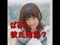 AKB48・島崎遥香の仰天“彼氏”発言!? ファン離れの「フルコース」でアイドル道から脱線確実