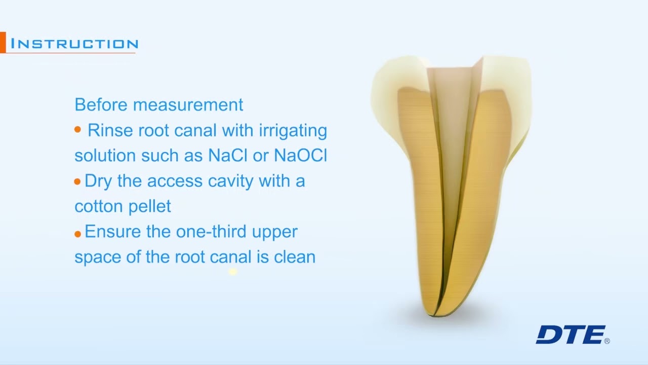 【Operation】- How to use - Dpex III