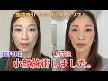 【美容】43歳!フェイスリフトで小顔&若返りました!