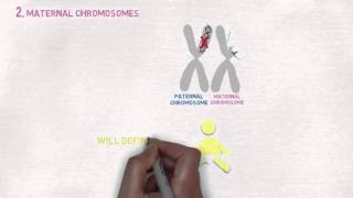 What is Focal Congenital Hyperinsulinism CHI?
