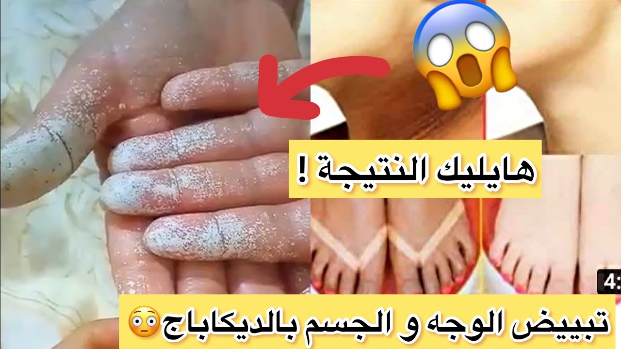 أجروا تسمعوا العجب😨والجديد تبييض الوجه و الجسم في 5 دقائق😱بالديكاباج 😏أنعم إيه بالديكاباج 👊🏻