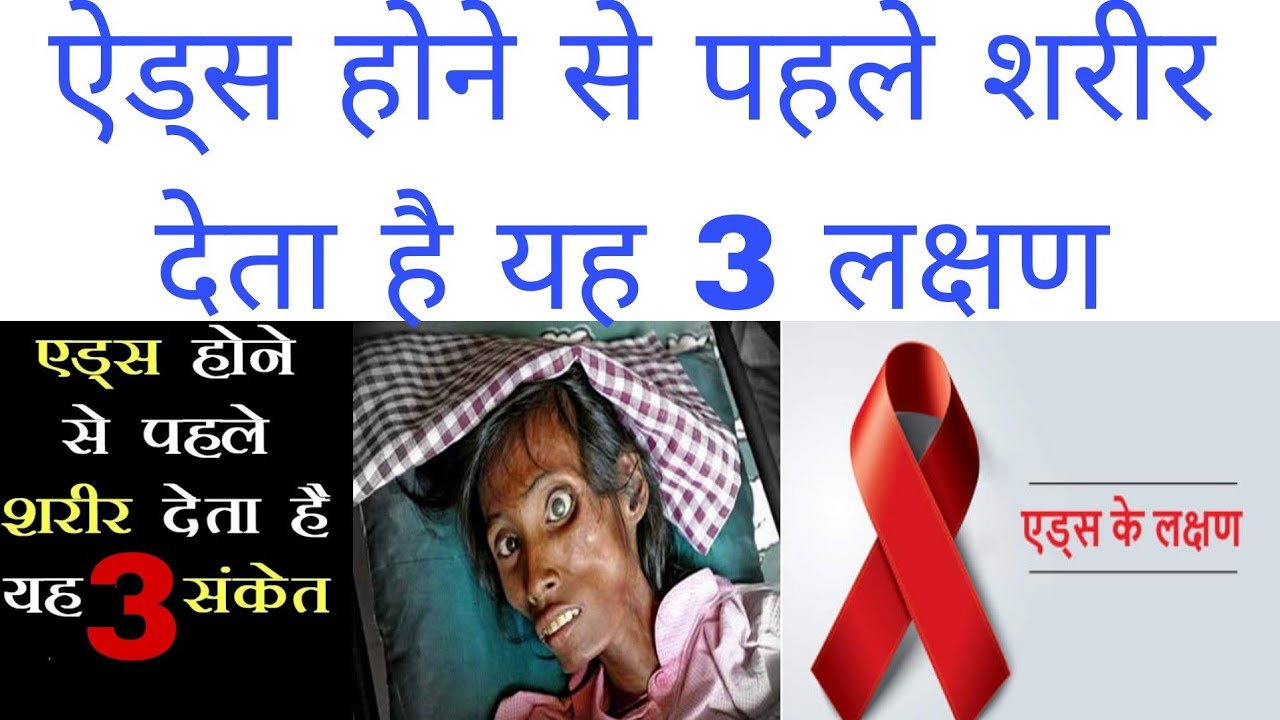 ऐड्स होने से पहले शरीर देता है यह 3 लक्षण | एड्स के लक्षण | Early symptoms of aids | HiV ke lakshan
