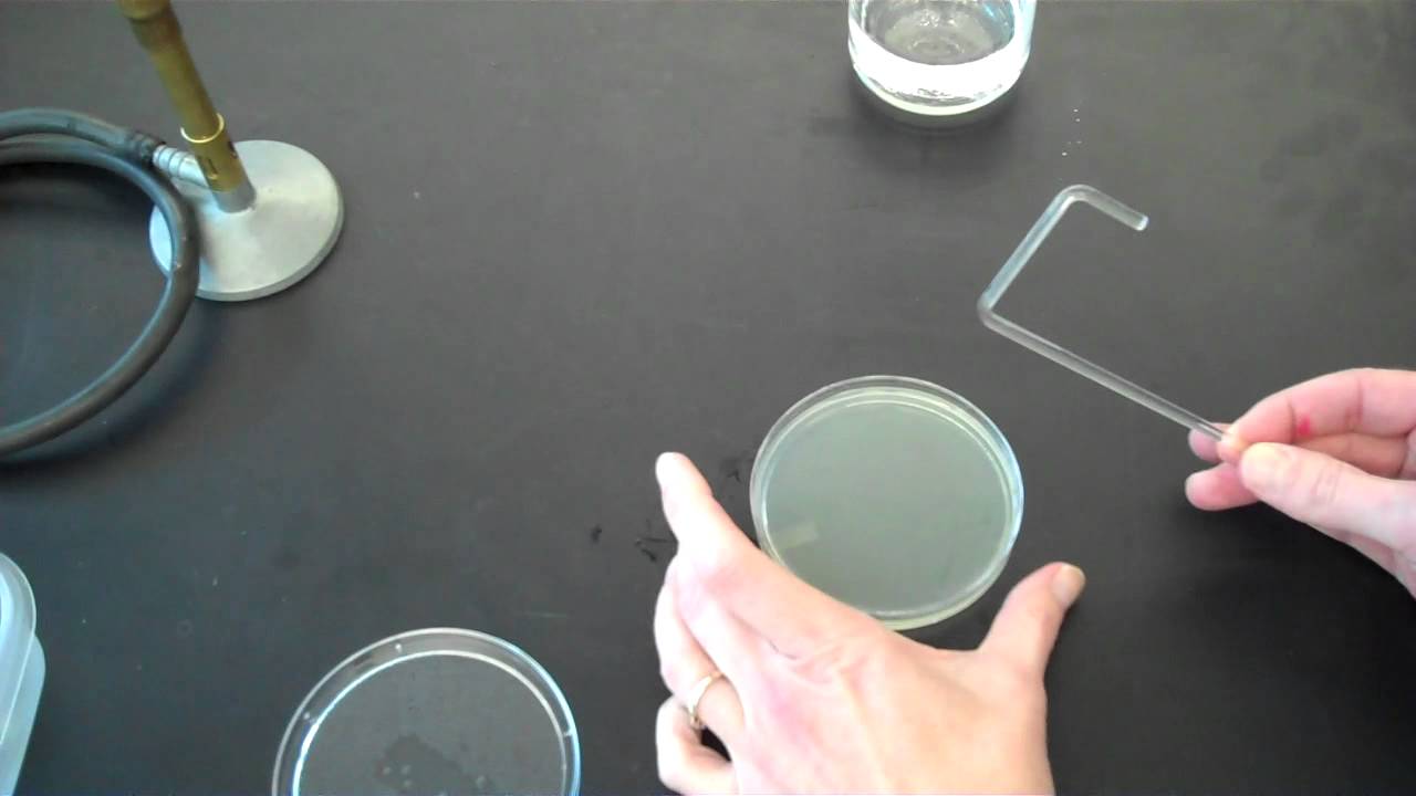 How Do Bacteria Spread On Agar Plates?