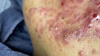 Download Lagu Relax Every Day SacDepSpa (Tuan P2-5) #988 MP3