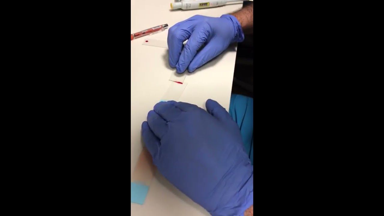 Periferik yaymanın yapılışı