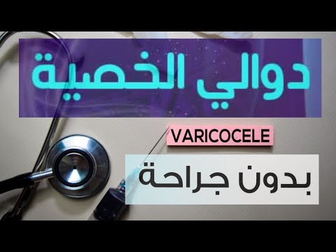 علاج دوالي الخصية دون جراحة مع الانصمام بواسطة الأشعة التداخلية