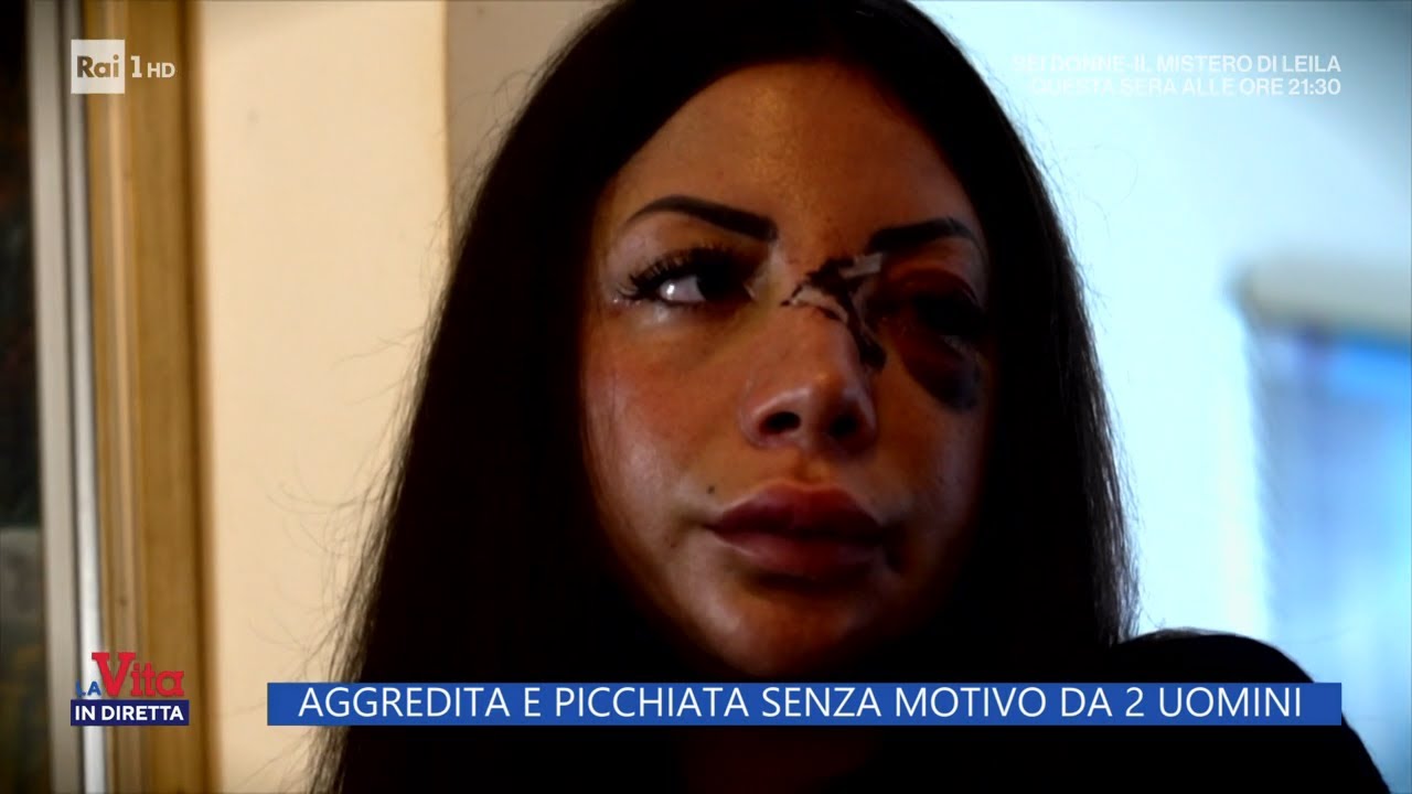 Prato, aggredita e picchiata senza motivo da 2 uomini - La vita in diretta 28/02/2023