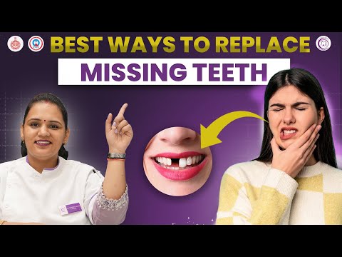 How to Replace Missing Teeth | Best Dental Options Explained 🦷