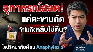 อุทาหรณ์สลด! แค่ตะขาบกัด ทำไมถึงหลับไม่ตื่น? ไขปริศนาภัยเงียบ Anaphylaxis
