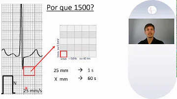 O que significa ritmo cardíaco irregular?