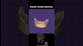 Full Denture Design