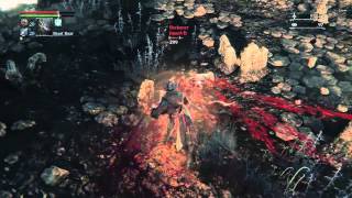 Crossu Countaa! - Bloodborne™