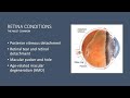 Demystifying Retinal Diseases Mp3 Song