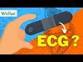 Understanding ECG and Home Monitoring