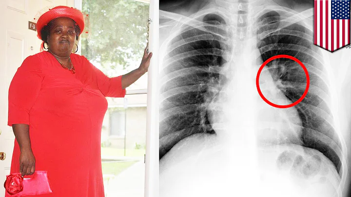 Woman dies after police arrest her in hospital, do...