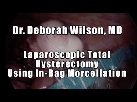 Laparoscopic Total Hysterectomy Using In-Bag Morcellation