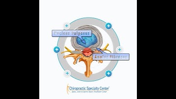 Protruded Disc: What You Need to Know (in 15 Seconds)