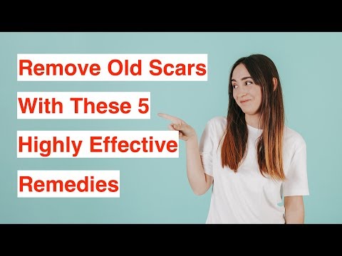 Video: Treatment Of Scars With Folk Remedies And Methods At Home