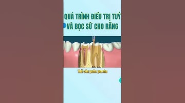 Quá trình điều trị tủy răng và bọc sứ cho răng |Dr Cường Offical #drcuong #shorts