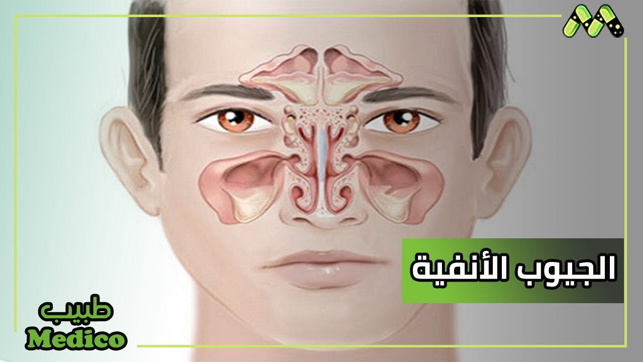 الجراحة أم العلاج؟؟! تعرف على طريقة علاج الجيوب الأنفية مع د. أحمد عبد ...