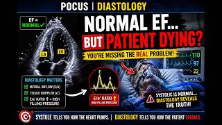 Point of Care Echo Diastology